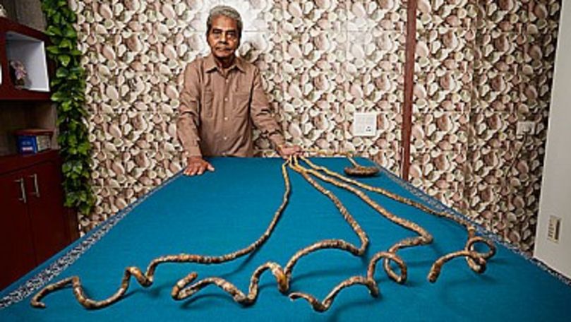 Un bărbat din India, în Guinness Book cu cele mai mari unghii la o mână