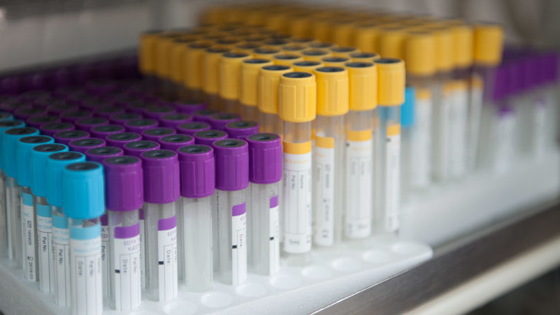 Bilanț: Numărul total al infectaților din R. Moldova trece de 17.000