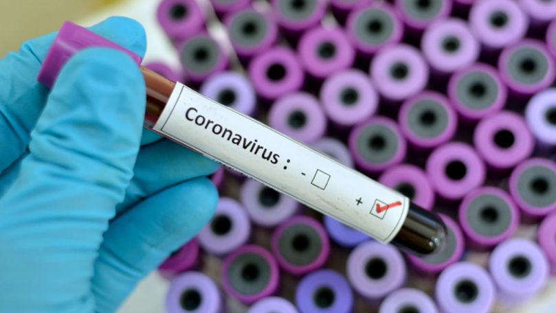 Bilanț: Încă 298 de persoane, infectate cu COVID-19 în R. Moldova