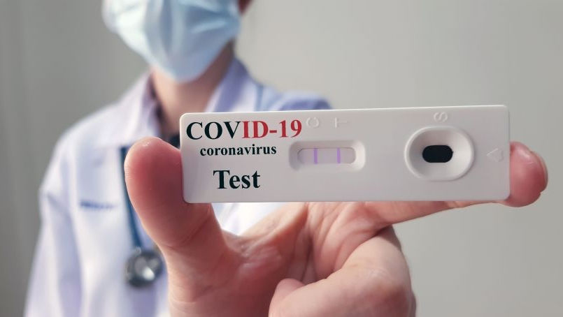 Săptămâna trecută în Moldova au fost înregistrate 52 cazuri de COVID-19.