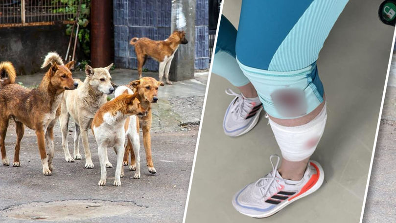 Собака покусала девушку в парке на Буюканах: "Что еще должно произойти?". Коллаж: Point.md