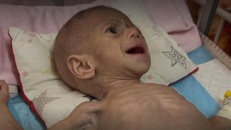 Un cameraman s-a întors în Gaza ca să afle soarta unei fetițe subnutrite