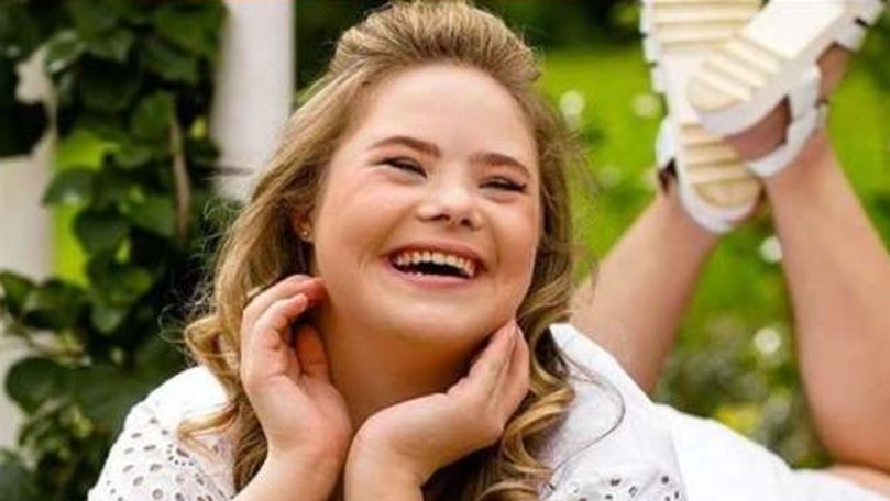 O fată de 14 ani cu sindromul Down a devenit model internaţional