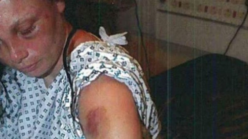 Gravidă bătută cu ciocanul de iubit. La ce orori a mai fost supusă