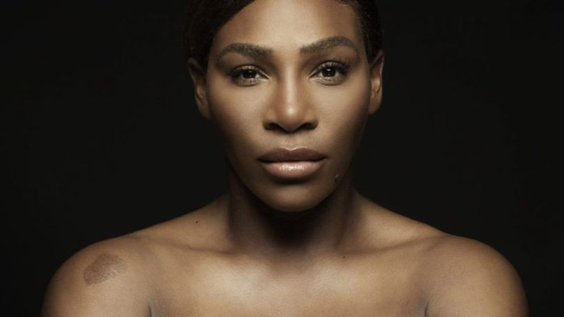 Serena Williams s-a dezbrăcat pentru o cauză nobilă