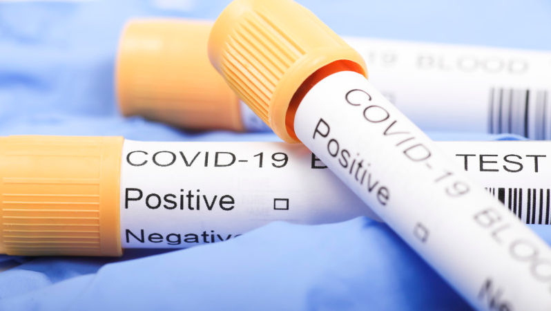 Bilanț COVID: Peste 380 de noi infectați și 7 decese într-o săptămână
