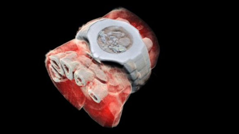 Cercetătorii au realizat prima radiografie 3D în culori a corpului uman