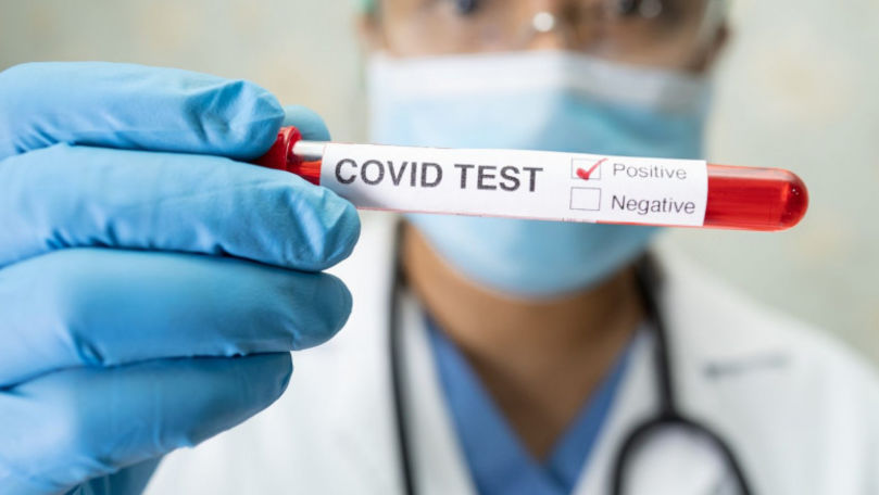 România: Un test COVID din 3 a fost pozitiv în ultimele 24 de ore