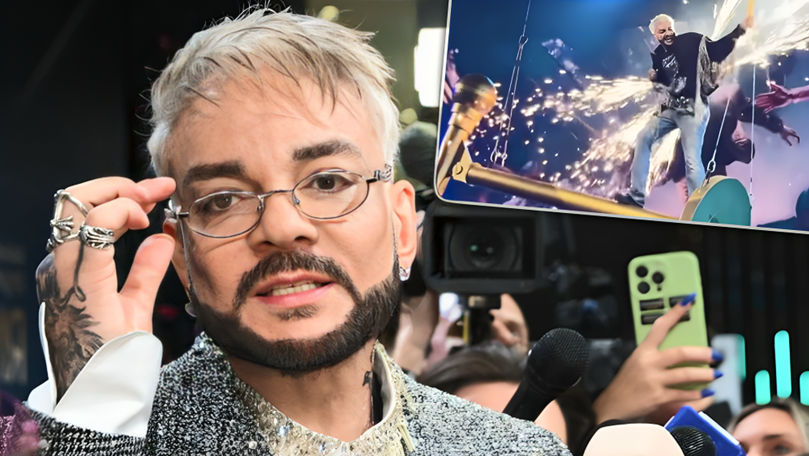 Ce spune chirurgul lui Filip Kirkorov despre starea artistului la moment