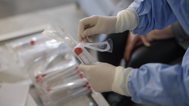 Rusia confirmă primul caz de infecție cu tulpina de coronavirus Kraken