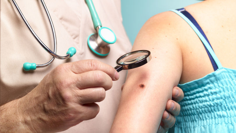 Un remediu pentru acnee promovat pe TikTok alarmează medicii