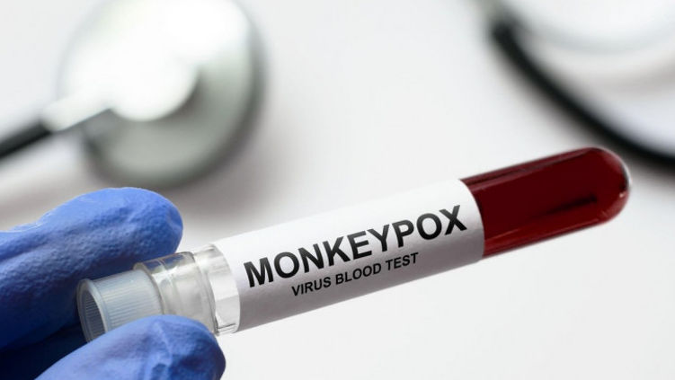 В Румынии зарегистрировано еще 9 случаев оспы обезьян.