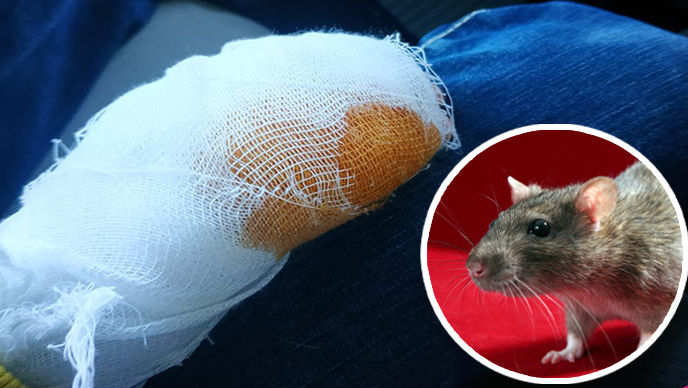Un copil a fost atacat și mușcat de mână de un șobolan în Capitală