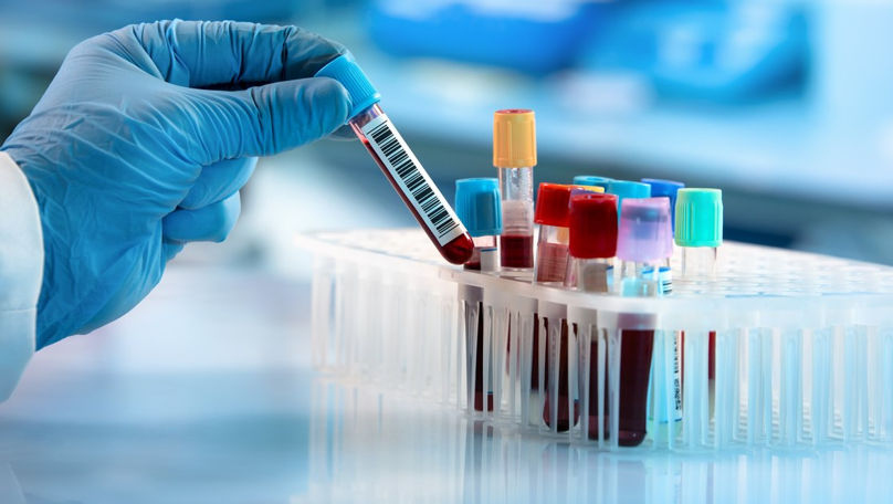 O analiză de sânge poate găsi cancerul înainte de apariția simptomelor