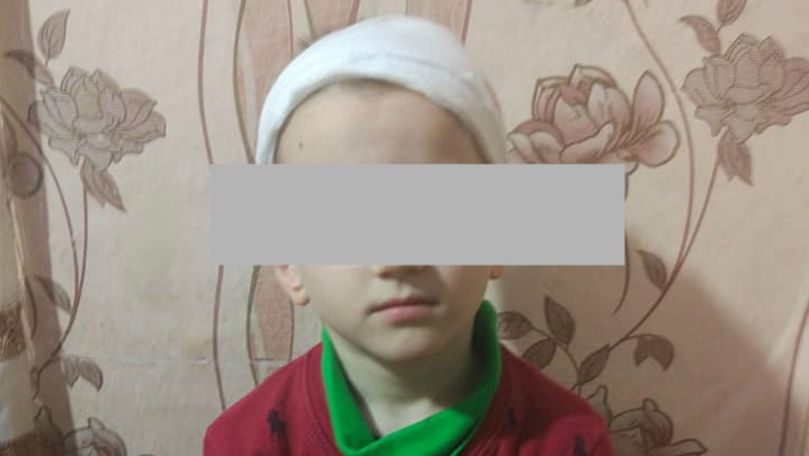 Copil rănit la cap în grădiniță: Acuzațiile mamei și precizarea Poliției