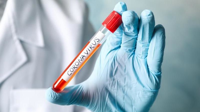 Власти хотят открыть еще две COVID-лаборатории на юге и севере страны.