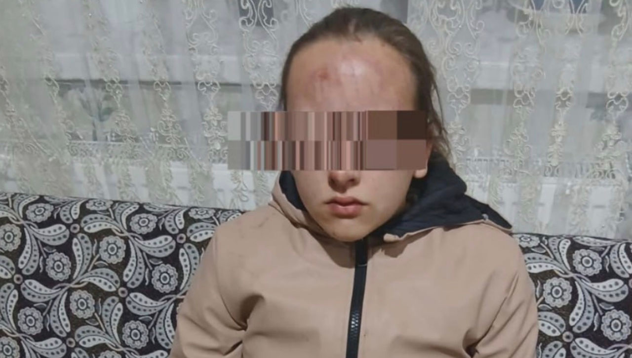 Полиция возбудила уголовное дело по факту избиения 13-летней девочки: она госпитализирована.