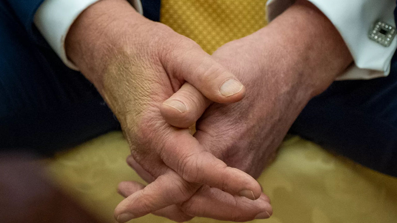 SUA au explicat deteriorarea stării de sănătate a lui Trump prin lupta împotriva radicalilor.