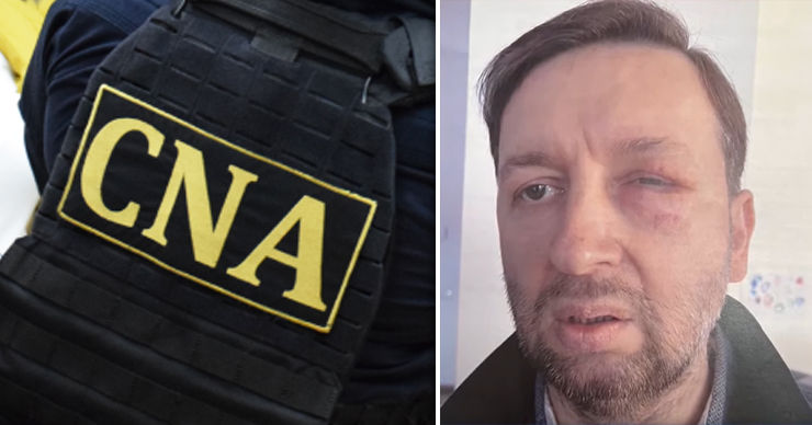 Офицеры НЦБК изъяли заключения врачей по травме Артура Решетникова. Коллаж: Point.md
