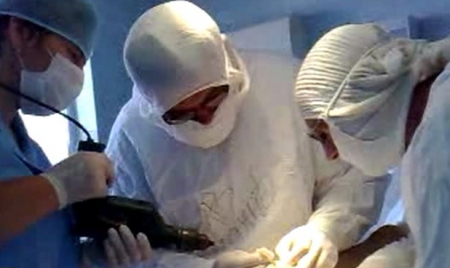 Medicii sunt nevoiţi să folosească instrumente industriale în intervenţiile chirurgicale. 