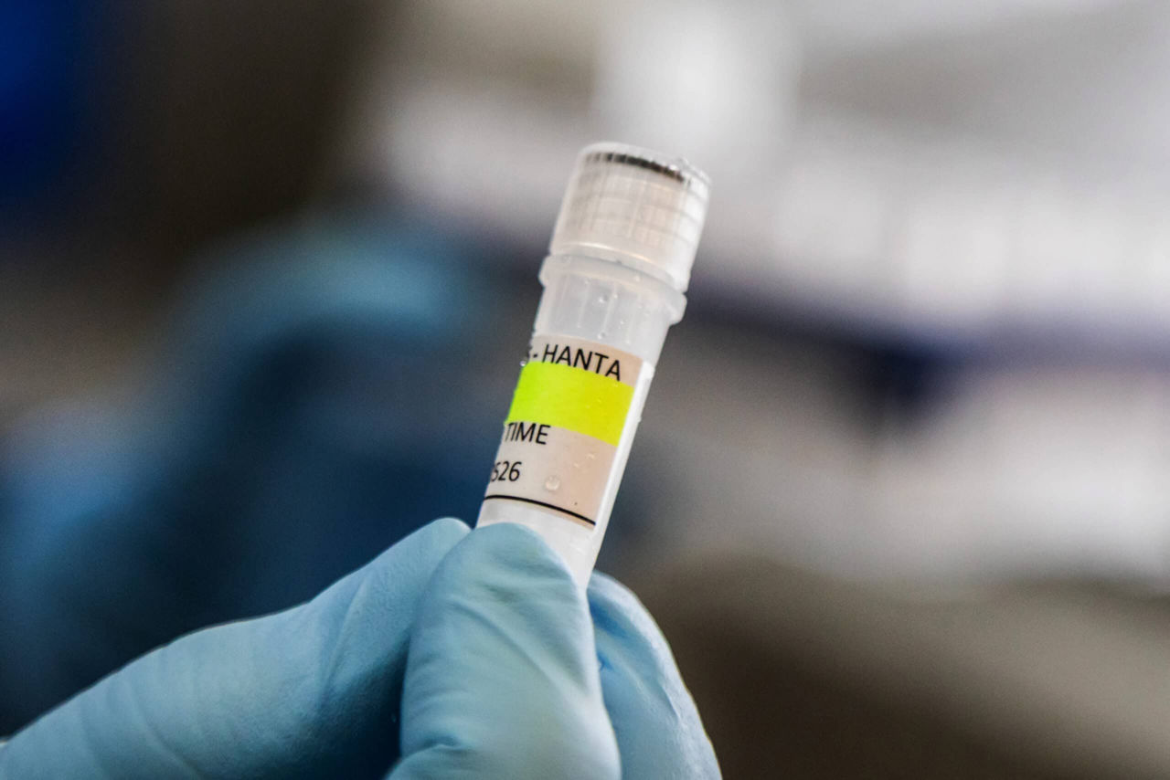 Вакцину против хантавируса разрабатывают годами из-за нехватки финансирования.