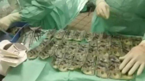 O tânără din Columbia a înghiţit nouă mii de dolari în bancnote de câte o sută de dolari. 