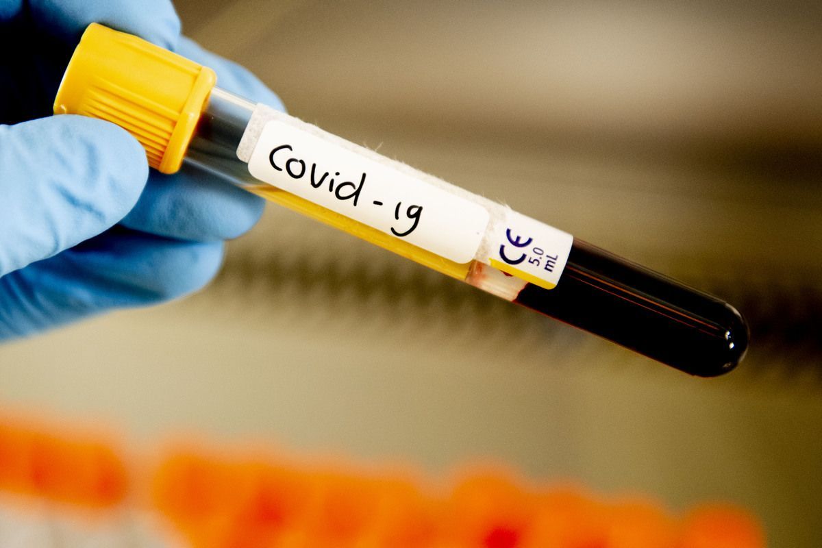 Вадим Красносельский призвал не экономить на COVID-тестировании.