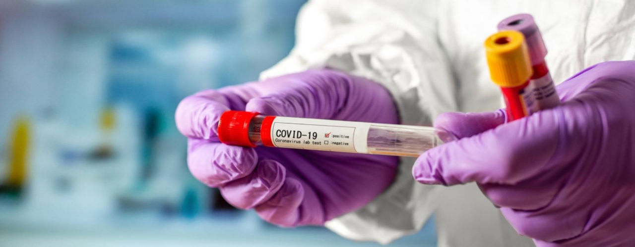 ВОЗ до конца недели определит новый статус COVID-19.