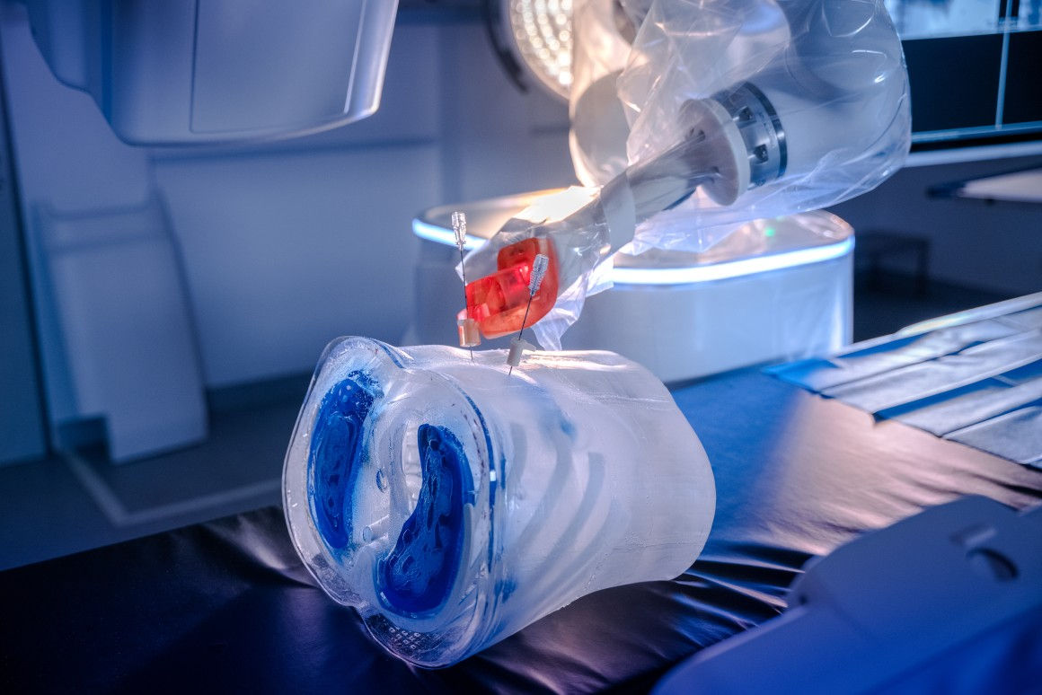 В Онкологическом институте Молдовы начали применять медицинского робота для биопсии.