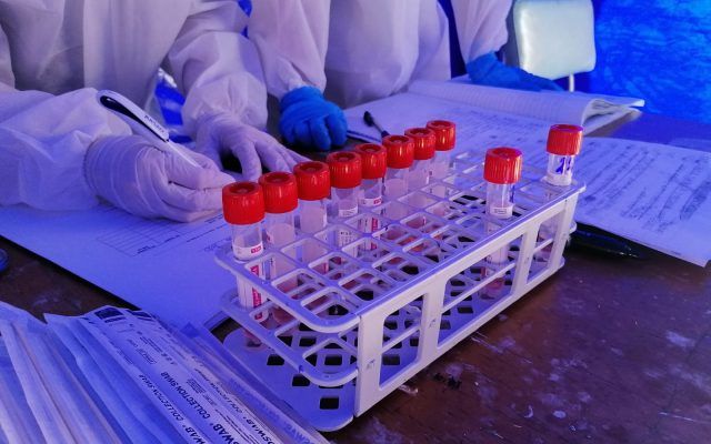 В Румынии от осложнений, вызванных COVID, скончались более 5000 человек.