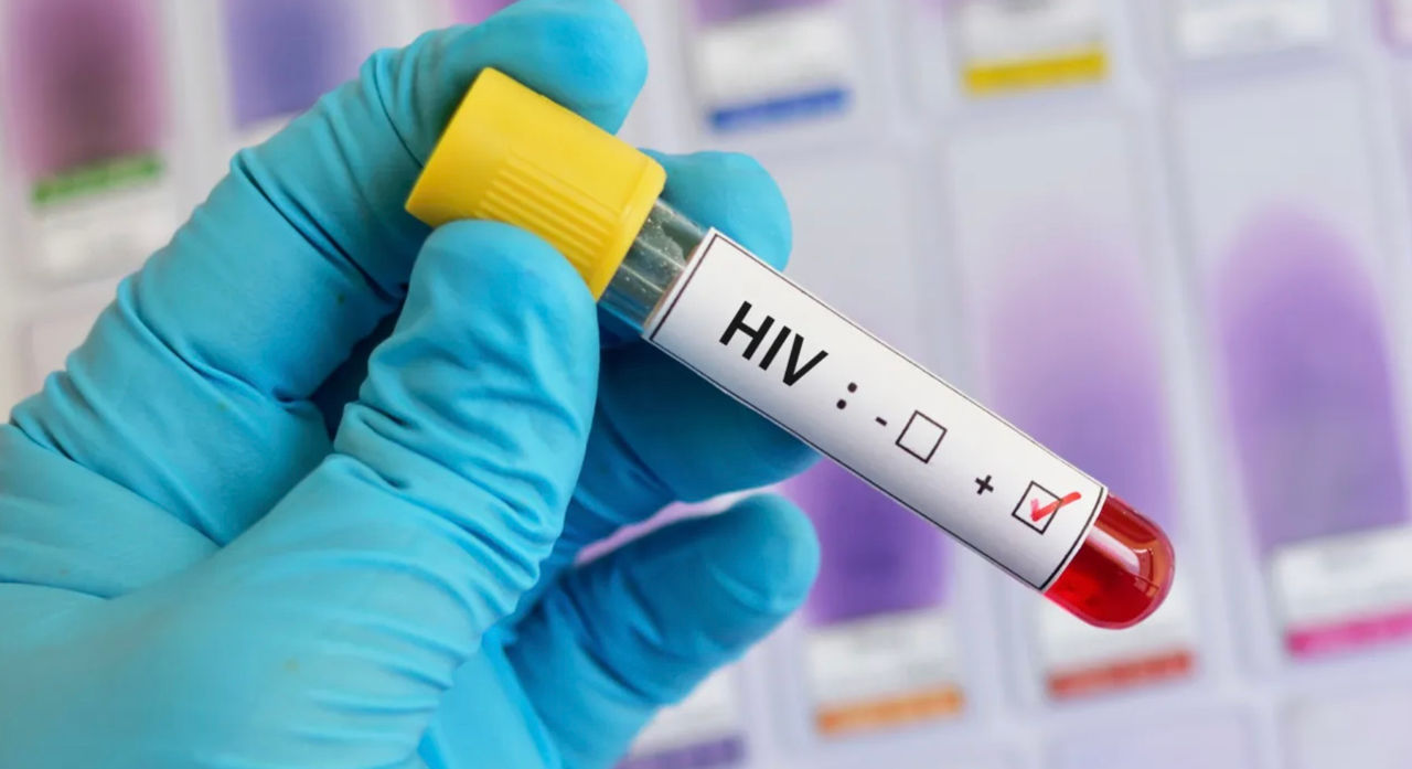 Persoanele cu HIV din Moldova își depistează tardiv statutul chiar dacă sunt testări accesibile.