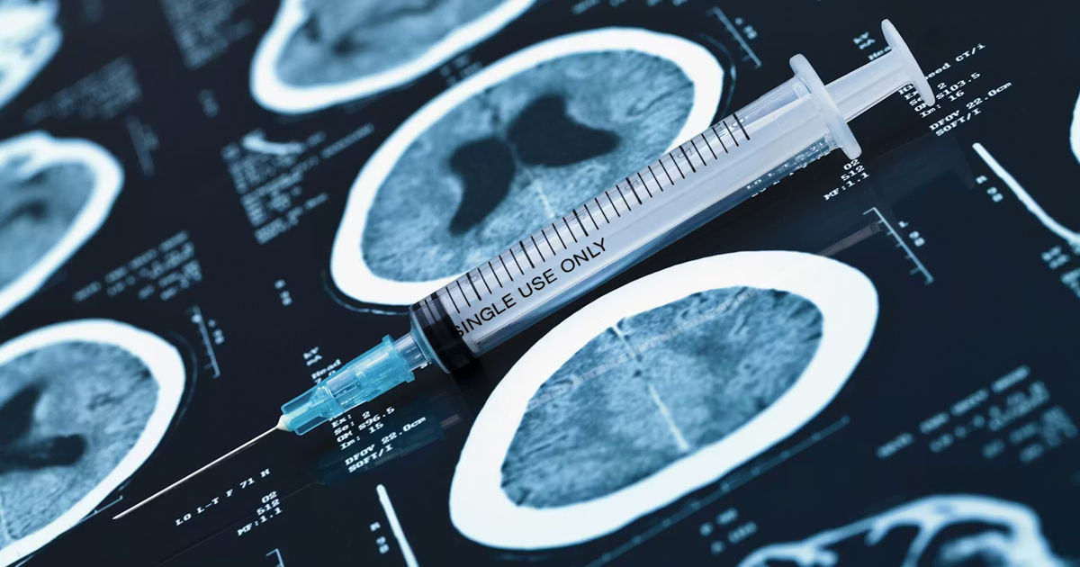 Un vaccin personalizat împotriva cancerului cerebral, dezvoltat în SUA.