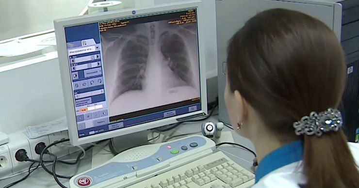 Самый неблагополучный район по заболеваемости туберкулезом - Слободзейский.