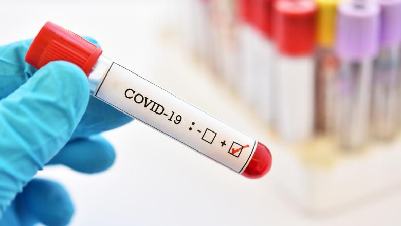 Рост числа случаев COVID-19 в Кишиневе: 808 новых случаев за неделю.