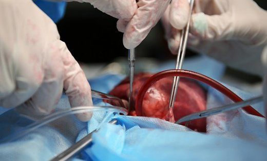13-летняя британка установила посмертный рекорд.