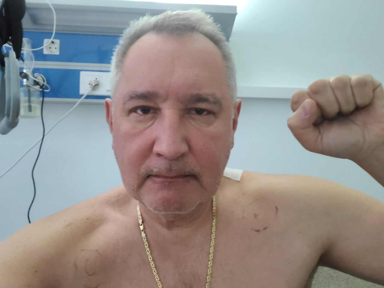 Дмитрий Рогозин выложил первое фото после операции.