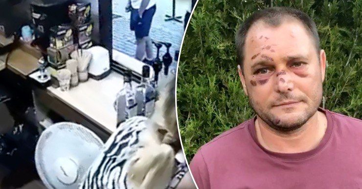 Драка в Оргееве. Жертва утверждает, что все произошло после сообщения о взятке в 150 тыс. евро.