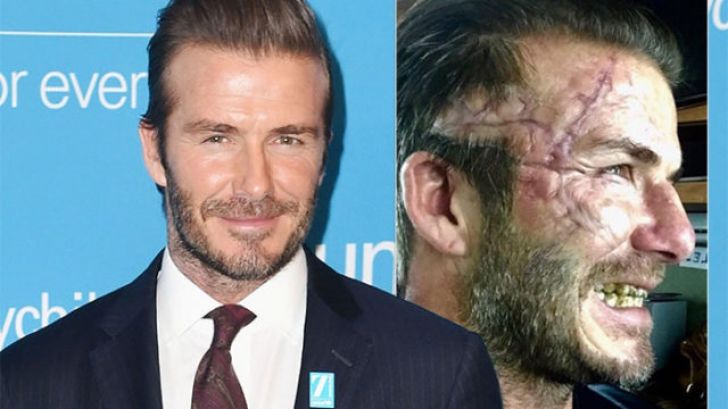 David Beckham are probleme psihice.