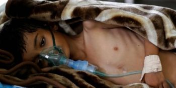 Organizația Mondială a Sănătății a cifrat vineri la 70.000 numărul cazurilor de holeră în Yemen.