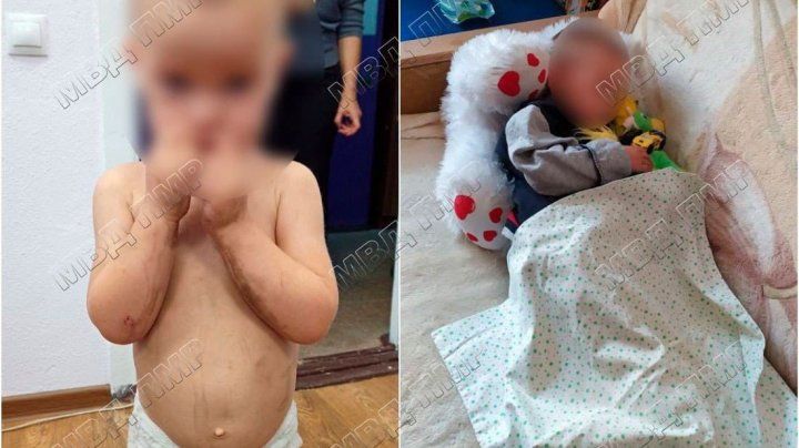 Происшествие в Бендерах: двухлетний мальчик сам гулял по улицам.