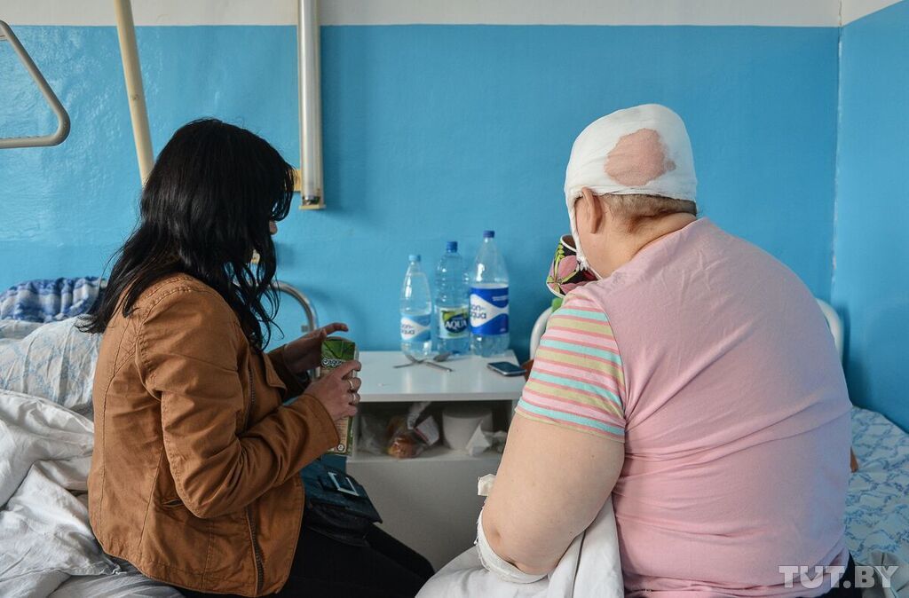Житель Бобруйска снял с жены скальп из-за волоса в пасхальном ужине.