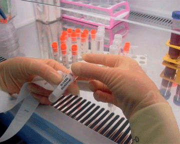 Так называемые индуцированные плюрипотентные стволовые клетки получают из клеток кожи самого пациента. Фото: acoona.net