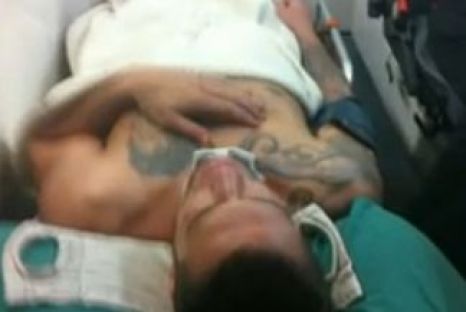 El a ajuns la spital în stare de inconştienţă după ce iubita lui efectiv i-a rupt penisul în timpul actului sexual. 
