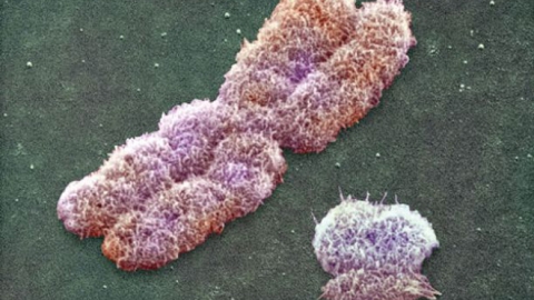 Rezultatele au fost publicate în revista "American Journal of Human Genetics".