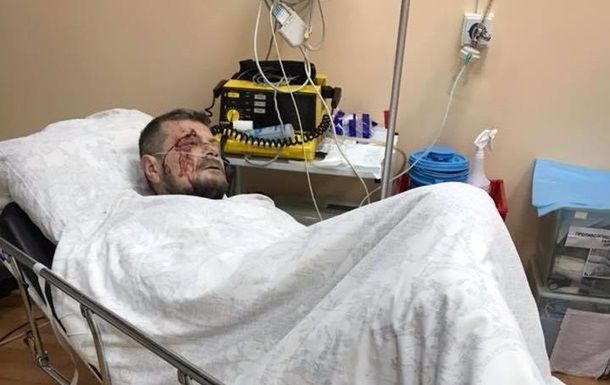 В МВД сообщили, что взрыв в центре Киева квалифицирован как теракт и его расследованием займется СБУ.