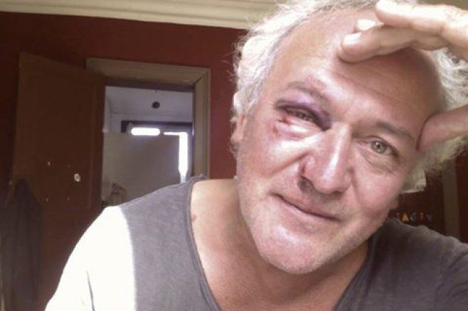 Scriitor român, bătut de țigani la Bruxelles: Tânjeau la computerul meu. Foto: timpul.md