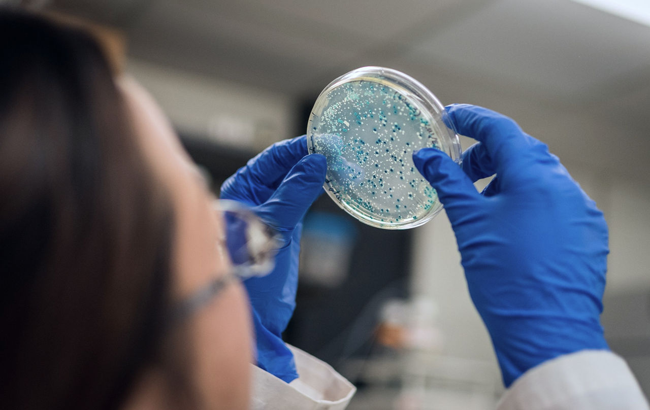 NASA ar fi putut transporta accidental bacterii terestre pe Marte.
