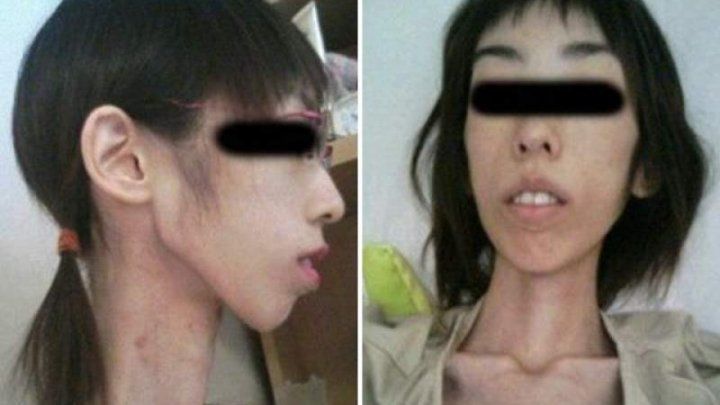  Bunicul i-a interzis să mănânce și a ajuns să cântărească 16 kilograme