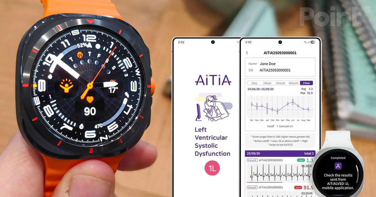 Dispozitivele Samsung vor învăța să identifice semnele precoce ale insuficienței cardiace.