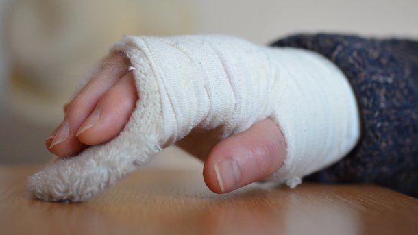 За последние 2 дня 11 человек обратились в бельцкую больницу с различными травмами и переломами.